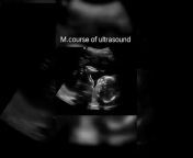 M.Course of ultrasound