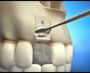 Durham Dental Implant Solutions