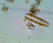DiatomSurirella spp.xxzz X600 Baybridge Intertidal 9 11 2014 (2) from xxzz