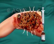 ASMR Maggot Infected Belly - Severely Injured Animation