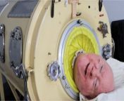 USA: Man who lived with an 'iron lung' due to polio dies aged 78 from man fucks chimpanzee