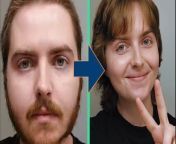 Credit: SWNS / Brendan McCann&#60;br/&#62;&#60;br/&#62;A trans woman has documented the physical changes in their face after eight months of Hormone Replacement Therapy (HRT) - by taking a selfie every day. &#60;br/&#62;&#60;br/&#62;Brendan McCann, 23, has photographed themself every day since they started HRT in August last year.&#60;br/&#62;&#60;br/&#62;They decided to document their journey to give other trans people the &#92;