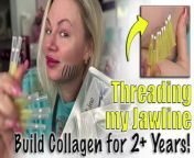 Subscribe&#60;br/&#62;Let&#39;s use threads in my jawline to build collagen and elastin. Threads break down over time, so they build collagen during that time. In this video I used pcl threads which last for 2 years! I think they are a great time/ money value!&#60;br/&#62;Get yoru PCL Screw threads Here: https://www.acecosm.com/categories/threads/screw-27g-50mm-pcl&#60;br/&#62;Code Jessica10 Saves you Money&#60;br/&#62;Note: Code Jessica10 is an affiliate code&#60;br/&#62;&#60;br/&#62;On this channel we talk about LIFE and I share MY OPINION. THIS IS JUST MY OPINION. You can and should speak to a professional and others in your life about any and all things that we discuss on this channel, this is just what I have to say based on my experience. SO do your own research please :)&#60;br/&#62;Join Locals - our Subscription Community (It&#39;s &#36;5 a month): https://wannabebeautygurus.locals.com&#60;br/&#62;&#60;br/&#62;Also email me if you want to be on the daily email blast list, or with questions: jessicajlcameron@yahoo.com&#60;br/&#62;&#60;br/&#62;My Priority Links (Youtube channels, Rumble, Favorite Skin Care and more) : https://qrco.de/bdAMP3&#60;br/&#62;&#60;br/&#62;If you would like to make a donation towards my content, please do so here (there are several ways to do so) but please note that it is not required in any way: https://www.wannabebeautyguru.com/donations&#60;br/&#62;&#60;br/&#62;We have MERCH! Get yours here: https://wannabe-beauty-guru.myspreadshop.com/&#60;br/&#62;&#60;br/&#62;You can see more videos, vlogs and resources for FREE over on my website: https://www.wannabebeautyguru.com (all I ask is when ordering please use my codes, I do get a small kick back and you save &#36;&#36;&#36;&#36; so it&#39;s a win win :)&#60;br/&#62;&#60;br/&#62;Join our facebook Group filled with wonderful, supportive skin care enthusiasts ! https://www.facebook.com/groups/553814011993661&#60;br/&#62;&#60;br/&#62;Join our NEW TO DIY Facebook group: https://www.facebook.com/groups/1626549951146756/&#60;br/&#62;&#60;br/&#62;My Channels - PLEASE SUBSCRIBE and HIT the BELL!&#60;br/&#62;~ Bitchute : https://www.bitchute.com/channel/axSbKNoHdhbj/&#60;br/&#62;&#60;br/&#62;~ Rumble: https://rumble.com/user/WannabeBeautyGuru&#60;br/&#62;&#60;br/&#62;~Discord: Here is the link to join the Discord group! https://discord.gg/bA7Cp9vA7j&#60;br/&#62;&#60;br/&#62;Instagram: https://www.instagram.com/wannabebeautygurujc/?hl=en&#60;br/&#62;&#60;br/&#62;Twitter: https://twitter.com/Wannabebeautyjc&#60;br/&#62;&#60;br/&#62;Things I love :&#60;br/&#62;~ Amazon Store : https://www.amazon.com/shop/influencer-a0791280&#60;br/&#62;~ www.acecosm.com https://bit.ly/3ANGX1Q (where you can buy Korean skin Care and more) ***Use code Jessica10 to save the most money*****&#60;br/&#62;~ www.maypharm.net https://bit.ly/3B4rVoA (where you can buy Korean skin Care , and more) ***Use code Jessica10 to save 13%*****&#60;br/&#62;~ www.glamcosm.com https://bit.ly/2XFdadc (where you can buy Korean skin Care, and more) ***Use code Jessica10 to save the most money*****&#60;br/&#62;~ www.glamderma.com https://bit.ly/2XFdadc (where you can buy Korean skin Care, and more) ***Use code Jessica10 to save the most money*****&#60;br/&#62;~ https://www.platinumskincare.com (where you can buy Peels, after care and more) ***Use code Jessica10 to save 10%*****&#60;br/&#62;~ Plasma Perfecting for your Skin Care devices (including radio frequency microneedling, led lights and more!) www.plasmaperfecting.com&#60;br/&#62;Code Jessi