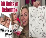 Subscribe&#60;br/&#62;Dehantox is my personal favorite toxin , it kicks in on me on day 3 with is pretty impressive! Today let&#39;s go over how I use it to freeze my face fully, specifically how and where I place 90 units over my face. I will review the muscles and where I inject as well as discussing depth and number of units!&#60;br/&#62;Get your Dehantox here: https://www.acecosm.com/search?q=deh&amp;type=product&#60;br/&#62;****Code Jessica10 Saves you Money&#60;br/&#62;Note: Code Jessica10 is an affiliate code&#60;br/&#62;&#60;br/&#62;Get other toxins here: https://www.acecosm.com/categories/botulinum-toxins&#60;br/&#62;****Code Jessica10 Saves you Money&#60;br/&#62;Note: Code Jessica10 is an affiliate code&#60;br/&#62;&#60;br/&#62;On this channel we talk about LIFE and I share MY OPINION. THIS IS JUST MY OPINION. You can and should speak to a professional and others in your life about any and all things that we discuss on this channel, this is just what I have to say based on my experience. SO do your own research please :)&#60;br/&#62;Join Locals - our Subscription Community (It&#39;s &#36;5 a month): https://wannabebeautygurus.locals.com&#60;br/&#62;&#60;br/&#62;Also email me if you want to be on the daily email blast list, or with questions: jessicajlcameron@yahoo.com&#60;br/&#62;&#60;br/&#62;My Priority Links (Youtube channels, Rumble, Favorite Skin Care and more) : https://qrco.de/bdAMP3&#60;br/&#62;&#60;br/&#62;If you would like to make a donation towards my content, please do so here (there are several ways to do so) but please note that it is not required in any way: https://www.wannabebeautyguru.com/donations&#60;br/&#62;&#60;br/&#62;We have MERCH! Get yours here: https://wannabe-beauty-guru.myspreadshop.com/&#60;br/&#62;&#60;br/&#62;You can see more videos, vlogs and resources for FREE over on my website: https://www.wannabebeautyguru.com (all I ask is when ordering please use my codes, I do get a small kick back and you save &#36;&#36;&#36;&#36; so it&#39;s a win win :)&#60;br/&#62;&#60;br/&#62;Join our facebook Group filled with wonderful, supportive skin care enthusiasts ! https://www.facebook.com/groups/553814011993661&#60;br/&#62;&#60;br/&#62;Join our NEW TO DIY Facebook group: https://www.facebook.com/groups/1626549951146756/&#60;br/&#62;&#60;br/&#62;My Channels - PLEASE SUBSCRIBE and HIT the BELL!&#60;br/&#62;~ Bitchute : https://www.bitchute.com/channel/axSbKNoHdhbj/&#60;br/&#62;&#60;br/&#62;~ Rumble: https://rumble.com/user/WannabeBeautyGuru&#60;br/&#62;&#60;br/&#62;~Discord: Here is the link to join the Discord group! https://discord.gg/bA7Cp9vA7j&#60;br/&#62;&#60;br/&#62;Instagram: https://www.instagram.com/wannabebeautygurujc/?hl=en&#60;br/&#62;&#60;br/&#62;Twitter: https://twitter.com/Wannabebeautyjc&#60;br/&#62;&#60;br/&#62;Things I love :&#60;br/&#62;~ Amazon Store : https://www.amazon.com/shop/influencer-a0791280&#60;br/&#62;~ www.acecosm.com https://bit.ly/3ANGX1Q (where you can buy Korean skin Care and more) ***Use code Jessica10 to save the most money*****&#60;br/&#62;~ www.maypharm.net https://bit.ly/3B4rVoA (where you can buy Korean skin Care , and more) ***Use code Jessica10 to save 13%*****&#60;br/&#62;~ www.glamcosm.com https://bit.ly/2XFdadc (where you can buy Korean skin Care, and more) ***Use code Jessica10 to save the most money*****&#60;br/&#62;~ www.glamderma.com https://bit.ly/2XFdadc (where you can buy Korean skin Care, and more) ***Use code Jessica10 to save the most money*****&#60;br/&#62;~ https://www.platinumskincare.com (where you can buy Peels,