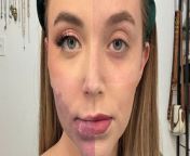 A woman who was born with a port wine stain birthmark on her face says trolls slam her for choosing to get laser surgery to lighten it. &#60;br/&#62;&#60;br/&#62;Danielle Lipple, 28, has a vascular malformation – an abnormal development of blood vessels – across her lower face, neck and on the inside of her mouth and throat.&#60;br/&#62;&#60;br/&#62;She has been getting laser surgery to lighten the birthmark since she was just aged one and believes she has had around 20 operations to date.
